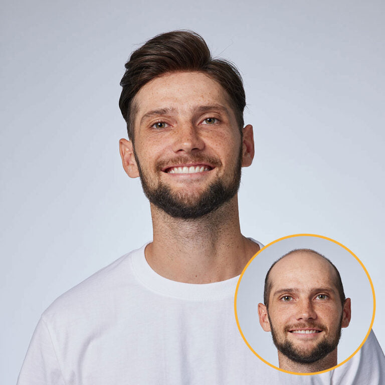 HS1V: V-Loop Hair System 0.06 mm Poly Thin Skin