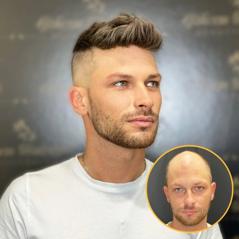 HS7: Full Swiss Lace Hair System Realistic Hairline