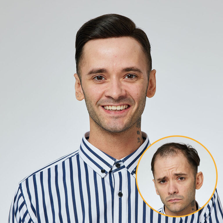 NEWAUSTRALIA: Swiss Lace Hair System With a Wider PU Perimeter