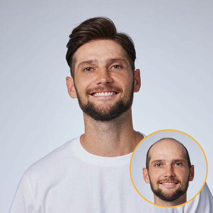 HS1V: V-Loop Hair System 0.06 mm Poly Thin Skin
