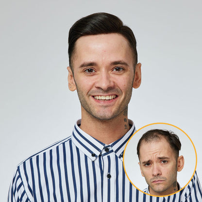NEWAUSTRALIA: Swiss Lace Hair System With a Wider PU Perimeter