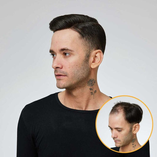 N6: Swiss Lace Hair System With PU Sides and back